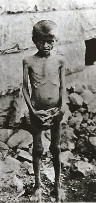 enfant armenien squelettique